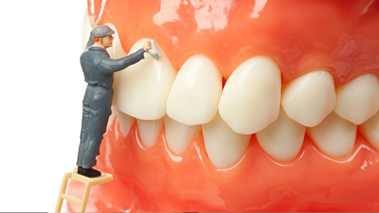 Dental Cleaning Take